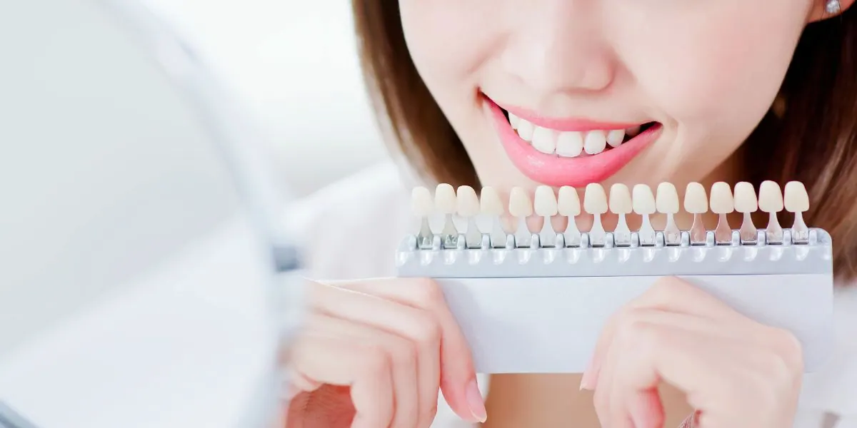 Teeth whitening
