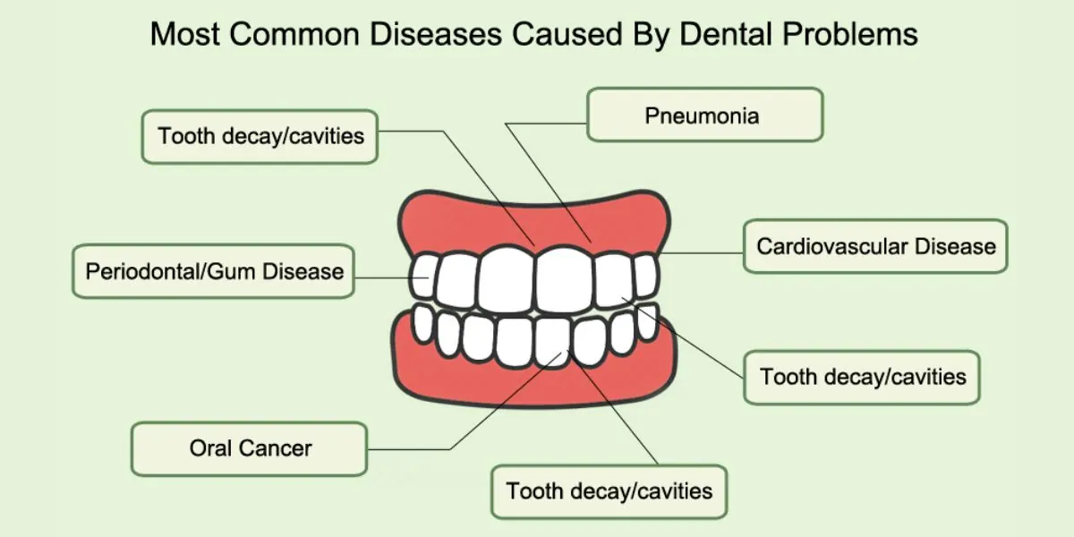 Common dental problems